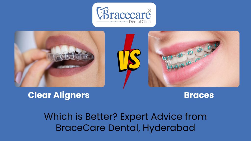 Clear Aligners vs Braces – Which Is Better? | BraceCare Dental Hyderabad